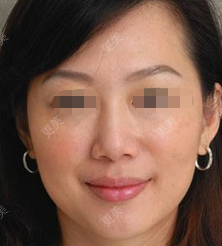 额头右边疼是怎么回事