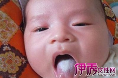 满月宝宝舌苔厚白是怎么回事