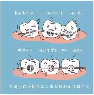 矫正牙齿的利与弊