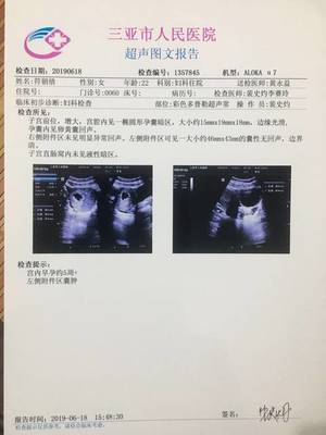 双侧卵巢多囊会怀孕吗