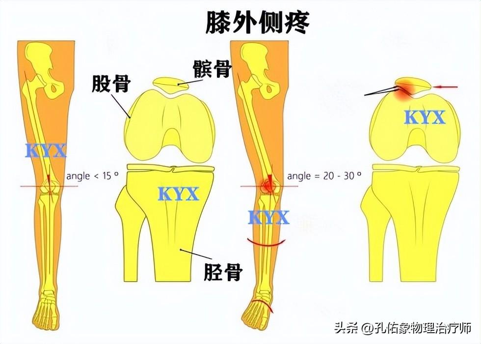 脚底内侧疼是怎么回事