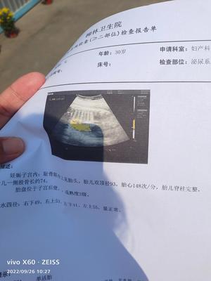 一般怀孕多久有心跳