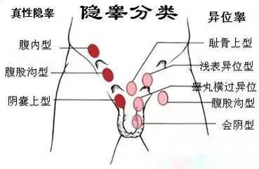 睾丸回缩是怎么回事
