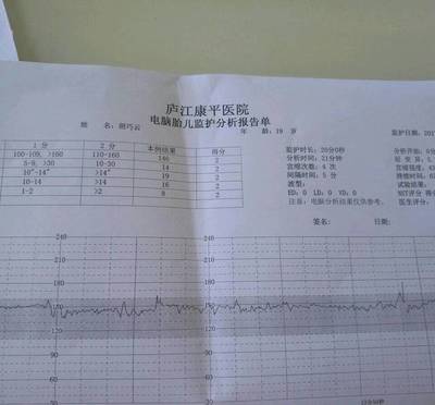 胎儿监护图怎么看