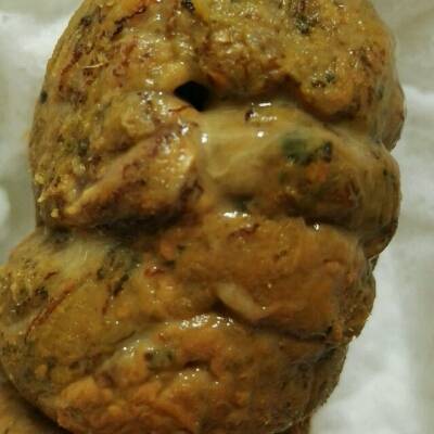大便带脓是怎么回事