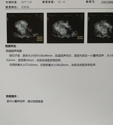 怀孕两个月宝宝多大