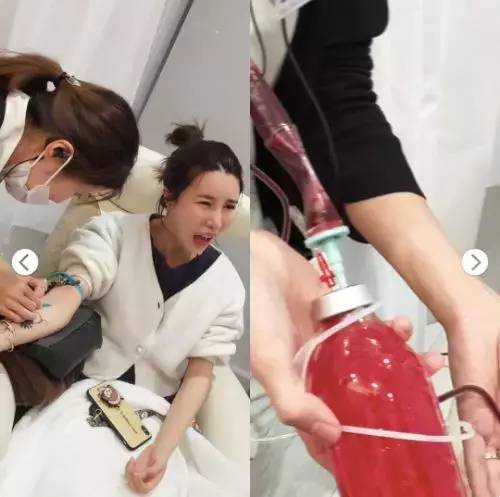 换血美容