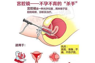 内膜息肉怎么治疗