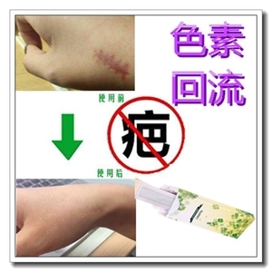 怎样去除痘痘黑印最快
