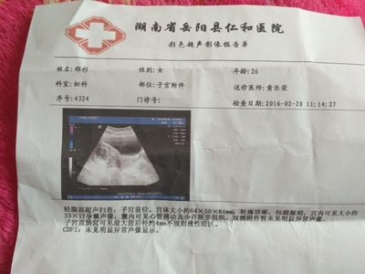 怀孕2个月最准看男女