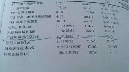 后顾之忧打一生肖