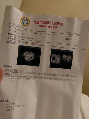 怀孕35天能看到孕囊吗