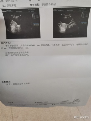 怀孕做彩超需要空腹吗