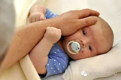新生儿单纯疱疹病毒感染