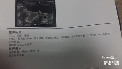 怀孕期间白带多