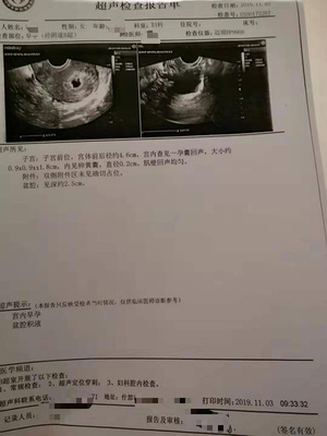 结扎三年了还会怀孕吗