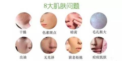 额头长痘痘能打肉毒素吗