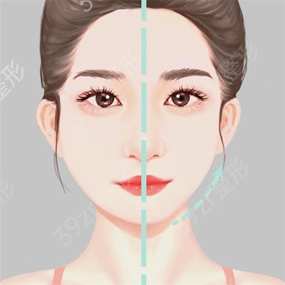 打玻尿酸多久消肿