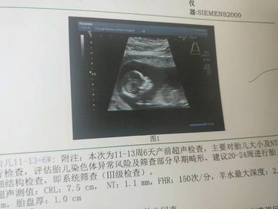 四个月胎动