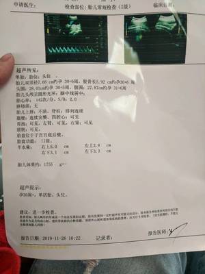 怀孕33周入盆正常吗