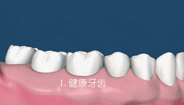牙齿保养办法