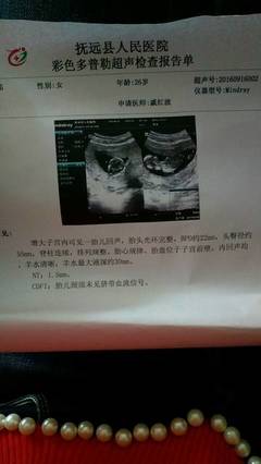三维四维彩超几个月做