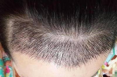 一个月头发能长多少厘米