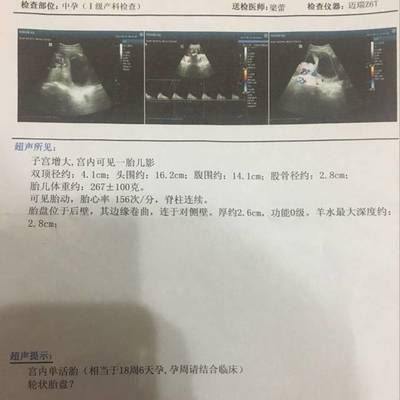 孕19周胎儿双顶径标准