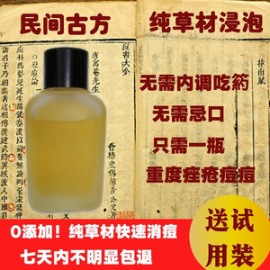 排完痘痘忌口