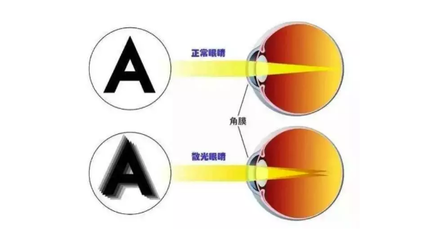 眼睛有重影是怎么回事
