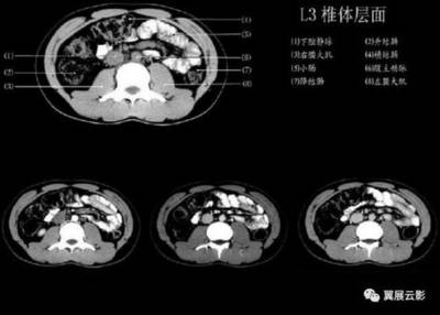 怎么看ct