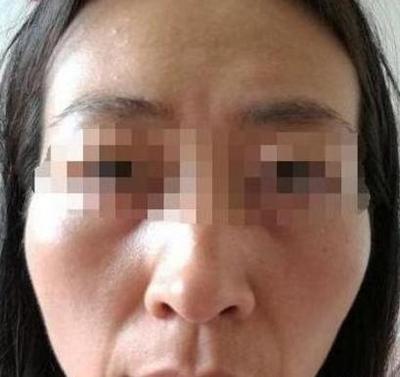 覆舟嘴面相一定不好吗