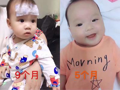 五个月大的宝宝发烧怎么办