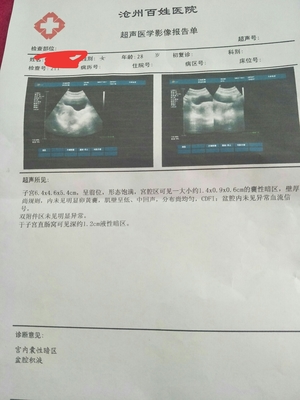 怀孕两天会恶心吗