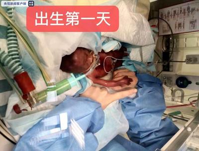 刚怀孕下面出血