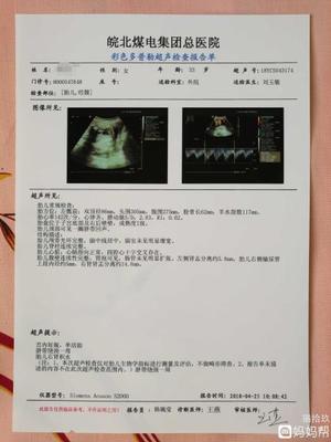 胎儿32周脐带绕颈一周怎么办