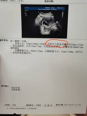 孕囊一周能长多少