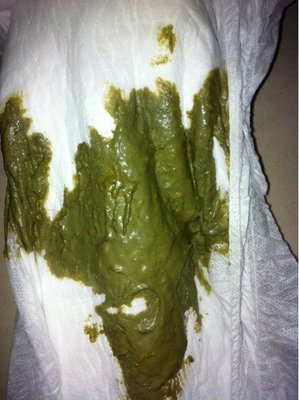 拉的粑粑是绿色的怎么回事