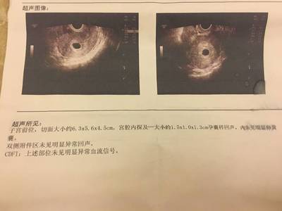 怀孕四十五天有什么反应