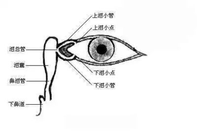 眼睛泪管堵塞怎么治疗
