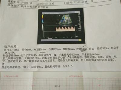 怀孕36周胎动减少正常吗