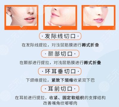 悬吊除皱v美减龄实力