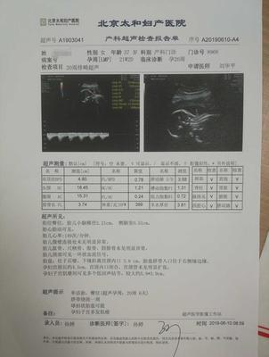 北京产检 价格多少钱