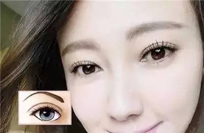 做了双眼皮多久能化妆