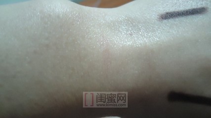 腿上毛孔发红