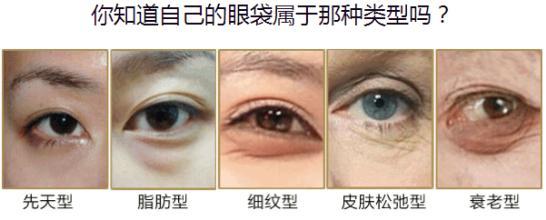 眼袋大是怎么回事