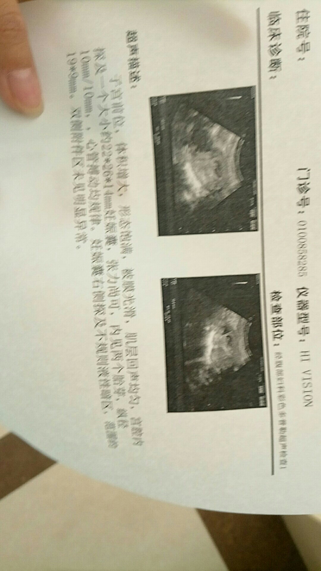 宫腔积血是怎么回事