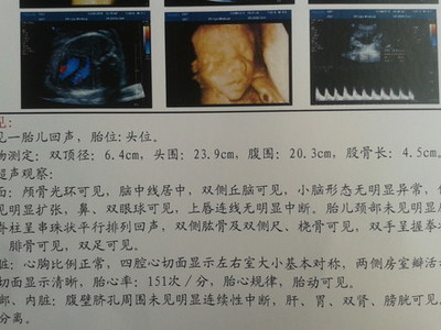 胎儿双顶径标准看男女