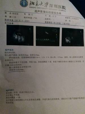 梦见自己怀男孩