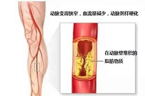 内膜增厚怎么治疗好